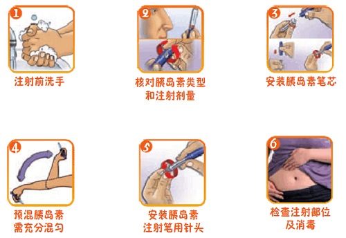 最新注射打胰島素視頻